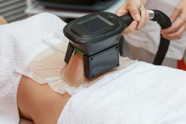 Image of person having fat freezing treatment to help weight gain Byfleet