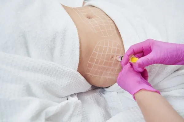 image of fat dissolving injections on love handles to help combat weight gain Byfleet