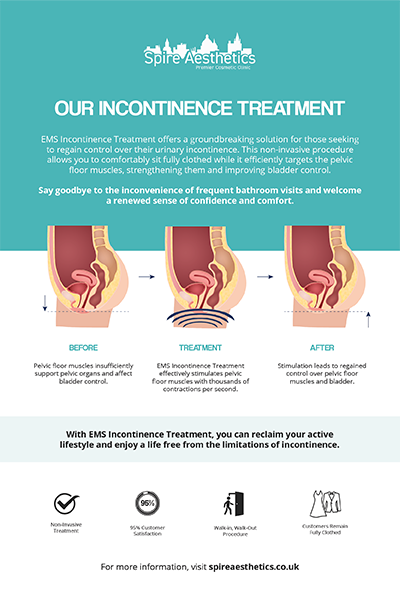 image of how urge incontinence Byfleet treatment works