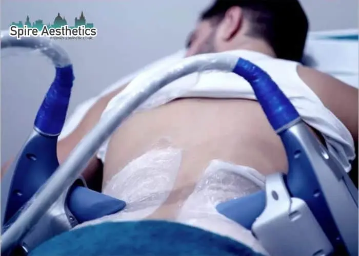 Man having fat freezing treatment done on love handles before a competitions Byfleet to create a sculpted look.